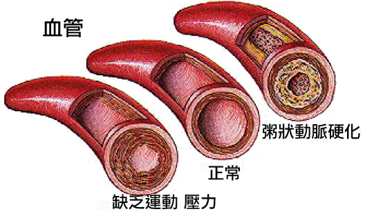 体温降低造成动脉硬化